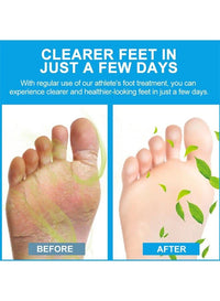 Sumifun - Foot Anti-Bacterial Cream (Original)